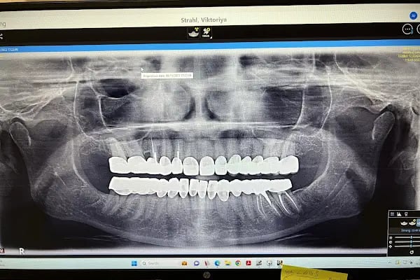 ÖZEL WESTDENT AĞIZ DİŞ HASTANESİ- Türkiye İzmir İmplant Diş Dent Clinic Türkey Dental İmplants in Turkey Zirconium in Turkey - Resim 5