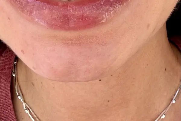 ÖZEL WESTDENT AĞIZ DİŞ HASTANESİ- Türkiye İzmir İmplant Diş Dent Clinic Türkey Dental İmplants in Turkey Zirconium in Turkey - Resim 12