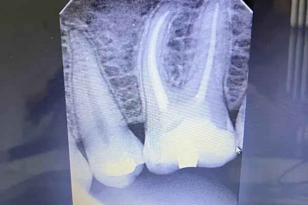 DURU DENT Ağız ve Diş Sağlığı Polikliniği - Resim 5