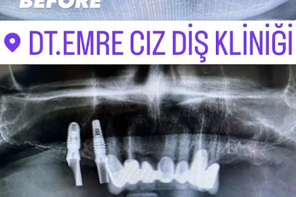 Diş Hekimi Emre Cız - Resim 4