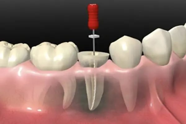 GataDent Diş Klinigi - Resim 9