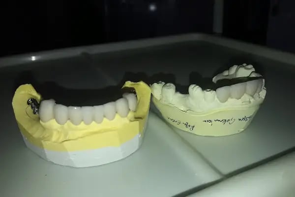 GataDent Diş Klinigi - Resim 7