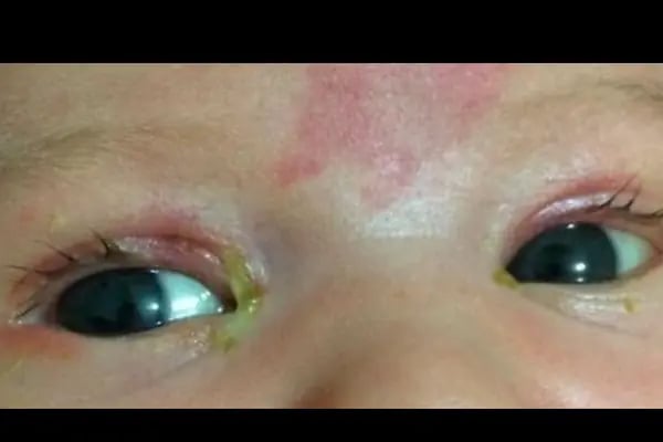 Prof. Dr. Yüksel Totan - Göz Doktoru - Retina Hastalıkları - Resim 17