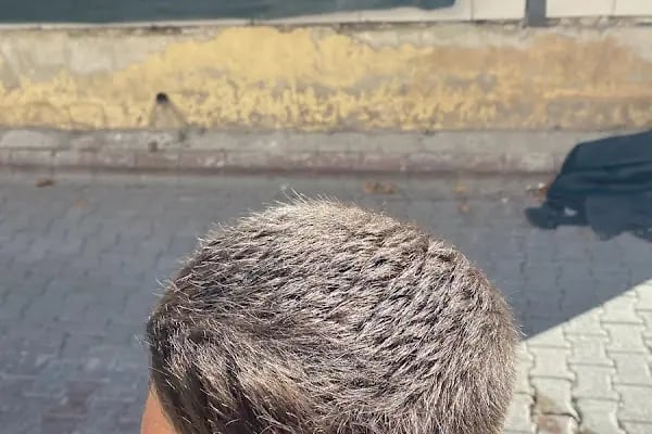 Fenomen Barbers Konya - Resim 13