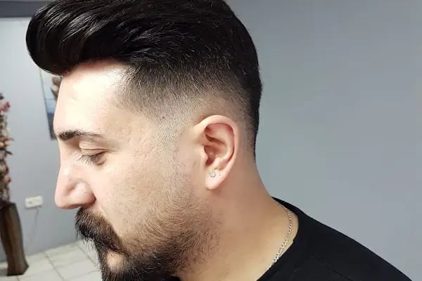 Protez Saç Ankara (Hairlife) - Resim 10