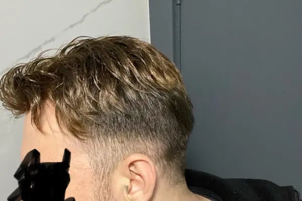 Protez Saç Ankara (Hairlife) - Resim 7