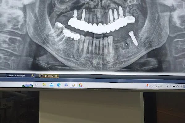 Özel Dentaperla Diamond Ağız ve Diş Sağlığı Polikliniği - Resim 14