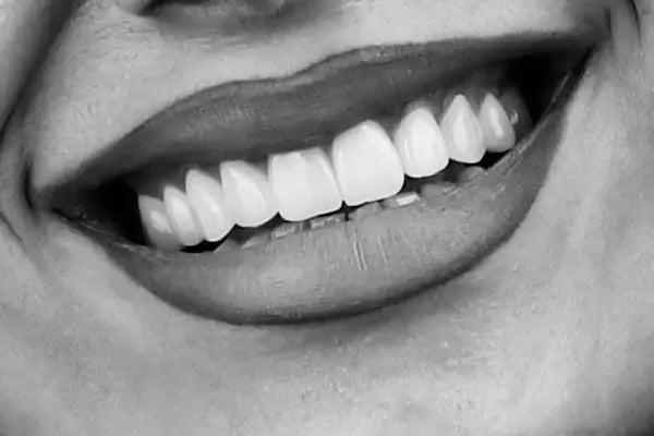 Dentalazer Ağız ve Diş Sağlığı Polikliniği - Resim 2