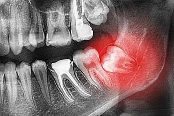 DENT 01 ÇENE CERRAHİSİ UZM. DR. Sadi Coşkun KANAL TEDAVİ UZMANI Uzm. Dr. Nihan Nazsız ve DİŞ HEKİMİ Görkem Güzel - Resim 20