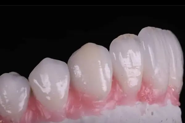 DENT 01 ÇENE CERRAHİSİ UZM. DR. Sadi Coşkun KANAL TEDAVİ UZMANI Uzm. Dr. Nihan Nazsız ve DİŞ HEKİMİ Görkem Güzel - Resim 15