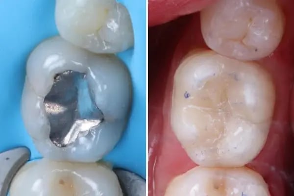 DENT 01 ÇENE CERRAHİSİ UZM. DR. Sadi Coşkun KANAL TEDAVİ UZMANI Uzm. Dr. Nihan Nazsız ve DİŞ HEKİMİ Görkem Güzel - Resim 11