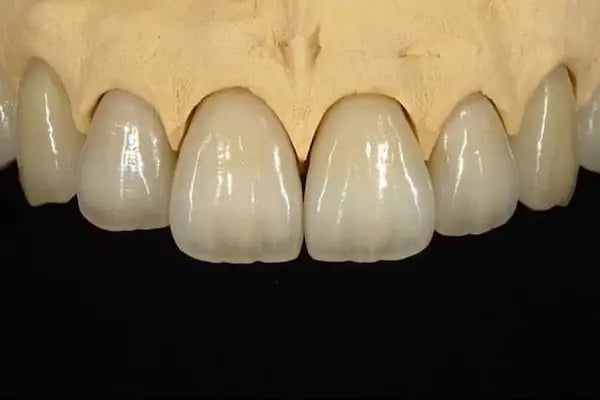 DENT 01 ÇENE CERRAHİSİ UZM. DR. Sadi Coşkun KANAL TEDAVİ UZMANI Uzm. Dr. Nihan Nazsız ve DİŞ HEKİMİ Görkem Güzel - Resim 19