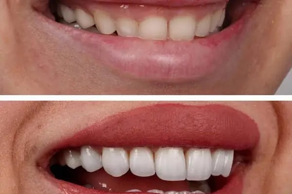 DENT 01 ÇENE CERRAHİSİ UZM. DR. Sadi Coşkun KANAL TEDAVİ UZMANI Uzm. Dr. Nihan Nazsız ve DİŞ HEKİMİ Görkem Güzel - Resim 5