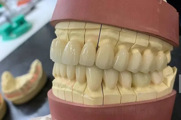 DENT 01 ÇENE CERRAHİSİ UZM. DR. Sadi Coşkun KANAL TEDAVİ UZMANI Uzm. Dr. Nihan Nazsız ve DİŞ HEKİMİ Görkem Güzel - Resim 9