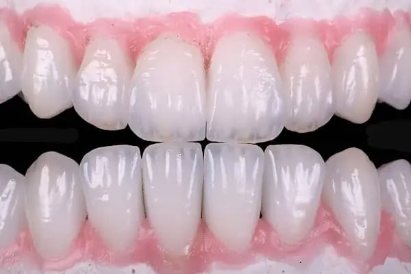 DENT 01 ÇENE CERRAHİSİ UZM. DR. Sadi Coşkun KANAL TEDAVİ UZMANI Uzm. Dr. Nihan Nazsız ve DİŞ HEKİMİ Görkem Güzel - Resim 2