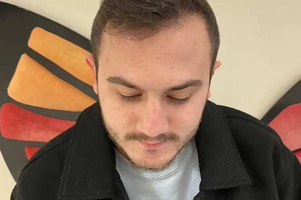 Bilyana Hair Clinic Saç Ekim Merkezi - Resim 12