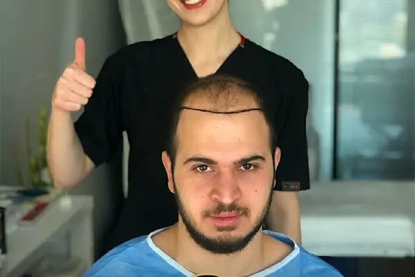 Hair Transplant Of Antalya / Antalya Saç Ekimi / Altınsoy Hair Clinic - Resim 14