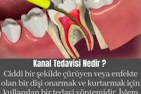 Elzem dent ağız ve diş sağlığı polikliniği - Resim 16