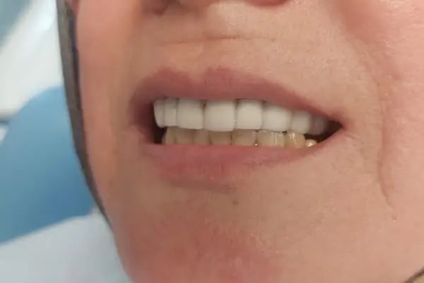 Özel Rana Altınışık Ağız ve Diş Sağlığı Polikliniği - Resim 14