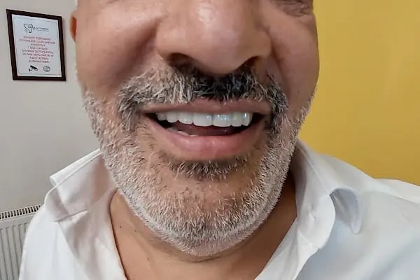 Özel Rana Altınışık Ağız ve Diş Sağlığı Polikliniği - Resim 13