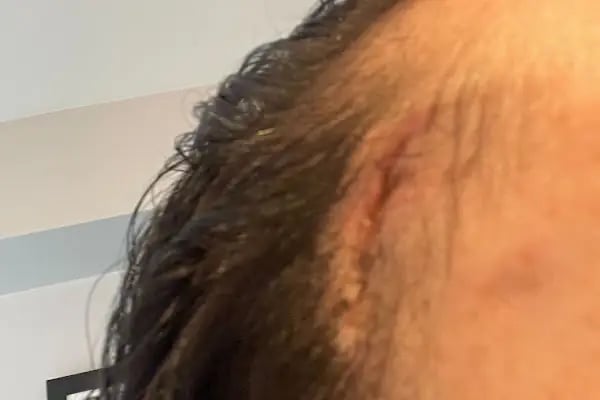 Prof. Dr. Hakan Şirinoğlu Estetik ve Plastik Cerrahi Kliniği - Resim 5