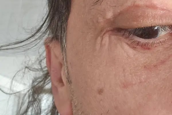 Ekol Hastanesi Estetik ve Plastik Cerrahi Kliniği - Resim 14