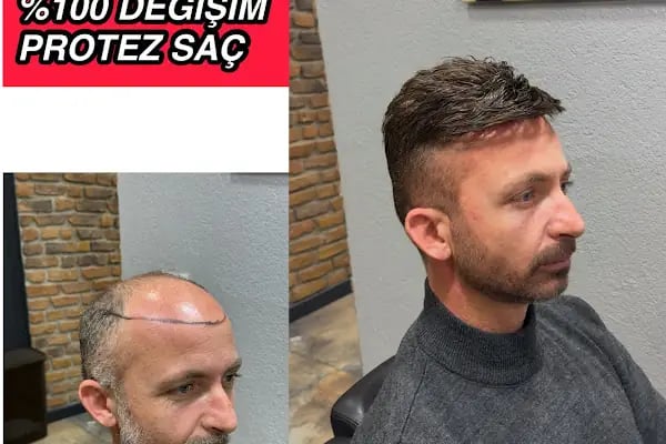 Hair Doctor Onur Topova Berber Güzellik Merkezi - Resim 18