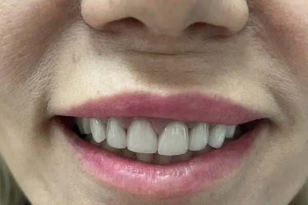 Özel Cantürk Ağız ve Diş Sağlığı Polikliniği - Resim 10