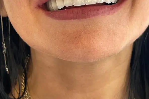 Laviva Ağız ve Diş Sağlığı Polikliniği - Resim 16