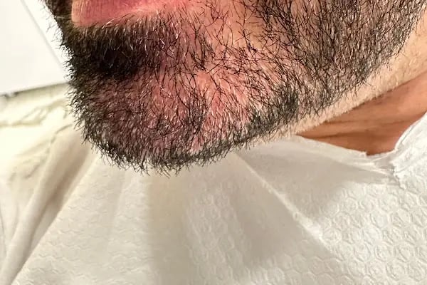 Laviva Ağız ve Diş Sağlığı Polikliniği - Resim 8