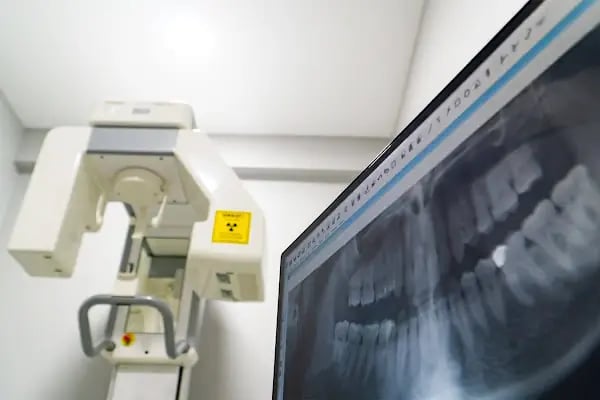Suat Eroğlu Diş Kliniği (Dt Suat Eroğlu-Dt Eda Birer) - Resim 5