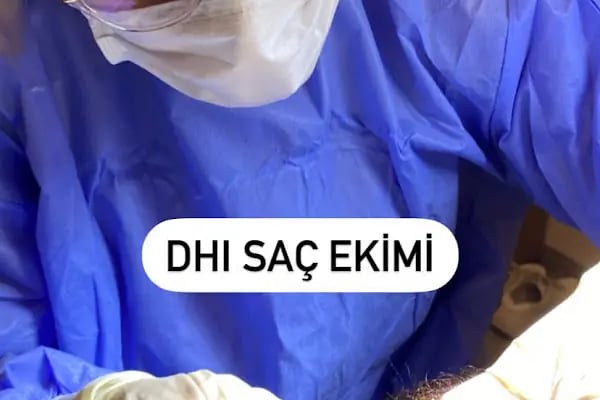 Dermatolog Prof Dr Şule Güngör, fraksiyonel lazer, akne izi tedavisi , İstanbul Kök hücre, Botoks (Botox) , Dolgu Saç Ekimi - Resim 9