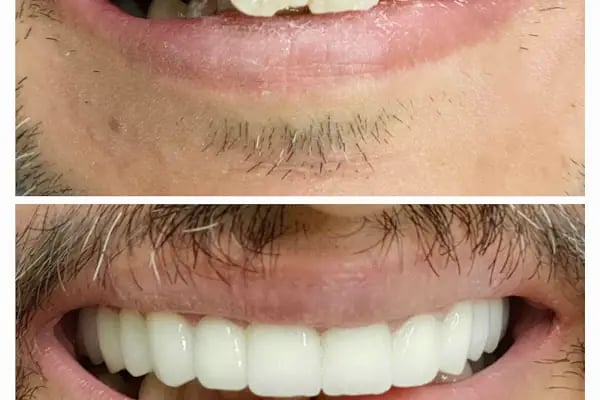 Ahsen Ağız ve Diş Sağlığı Polikliniği - Resim 16