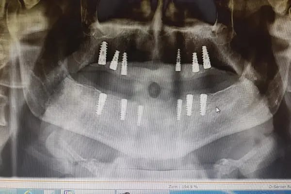 Urfadent Udentoconcept Ağız ve Diş Sağlığı Polikliniği - Resim 6