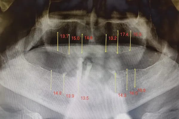 Urfadent Udentoconcept Ağız ve Diş Sağlığı Polikliniği - Resim 15