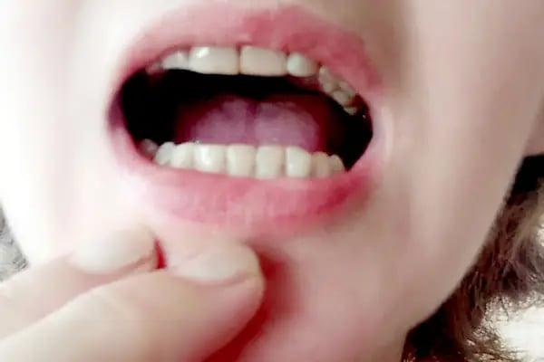 Özel Güleryüz Ağız ve Diş Sağlığı Polikliniği - Resim 4