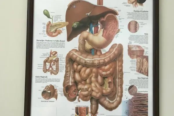 Ankara Endoskopi-Kolonoskopi Gastroenteroloji (Mide Balonu) Merkezi Dr. Meral SÖZEN Gastroenteroloji UZMANI Yapay Zeka İle Kolonoskopi - Resim 16