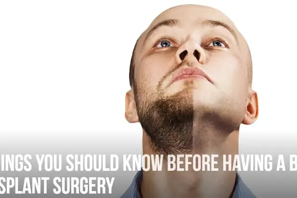 Beard Transplant Turkey - Resim 5