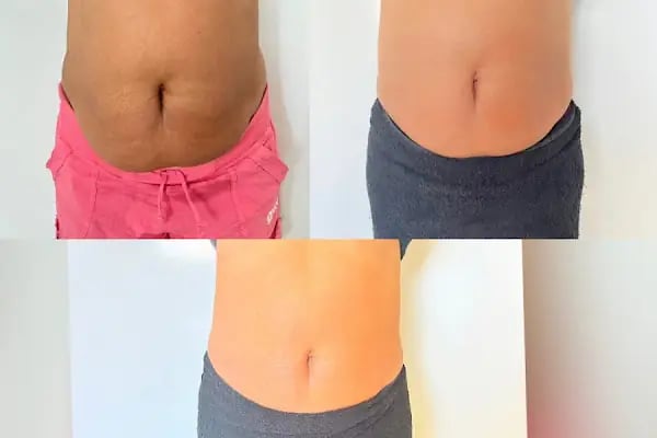 Eva Beauty Studio &amp; beauty 4 you kuaför+ güzellik merkezi - Resim 15