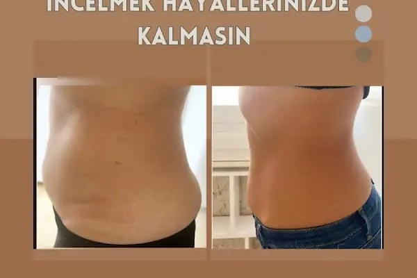 Eva Beauty Studio &amp; beauty 4 you kuaför+ güzellik merkezi - Resim 17