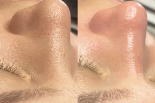 Eva Beauty Studio &amp; beauty 4 you kuaför+ güzellik merkezi - Resim 11