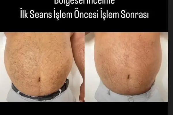 Eva Beauty Studio &amp; beauty 4 you kuaför+ güzellik merkezi - Resim 9