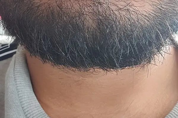 Kaplan DentAlanya Ağız ve Diş Sağlığı Polikliniği - Resim 15