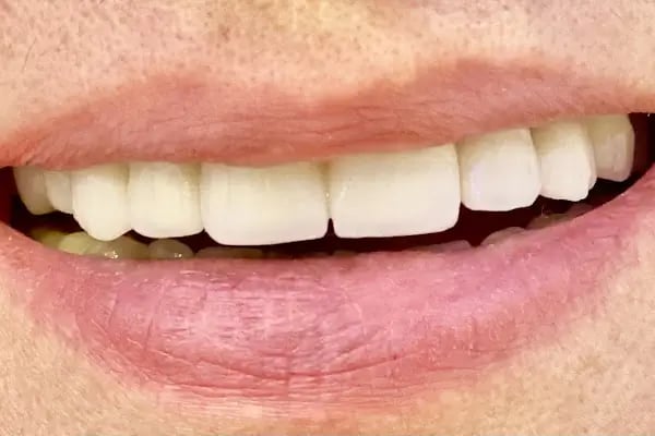 Markasya Ağız Ve Diş Sağlığı Polikliniği - Resim 10
