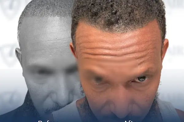 Live Hair Clinic - Resim 1