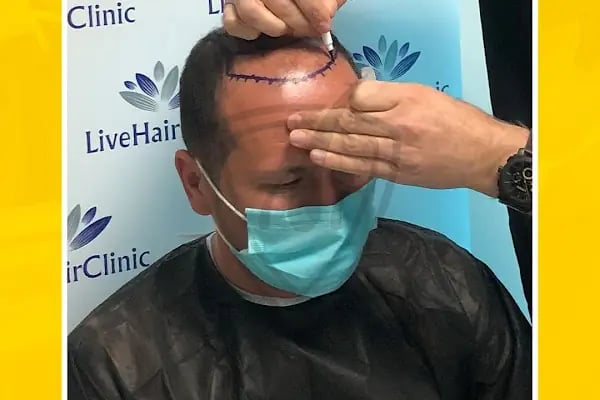 Live Hair Clinic - Resim 15