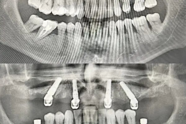 EU DENT Ağız ve Diş Sağlığı Polikliniği - Resim 17