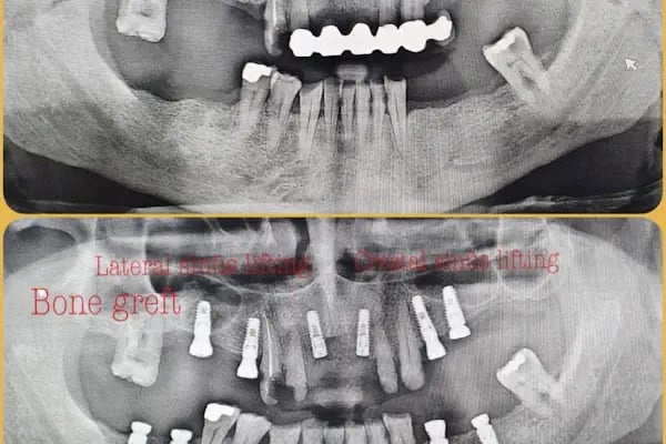 EU DENT Ağız ve Diş Sağlığı Polikliniği - Resim 18