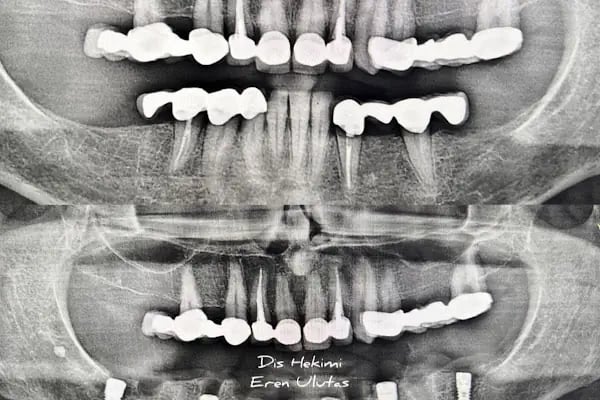 EU DENT Ağız ve Diş Sağlığı Polikliniği - Resim 13