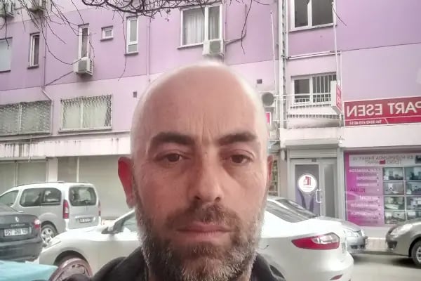 AY-ÇA Saç Ekimi & Estetik & Lazer Epilasyon Antalya - Resim 8